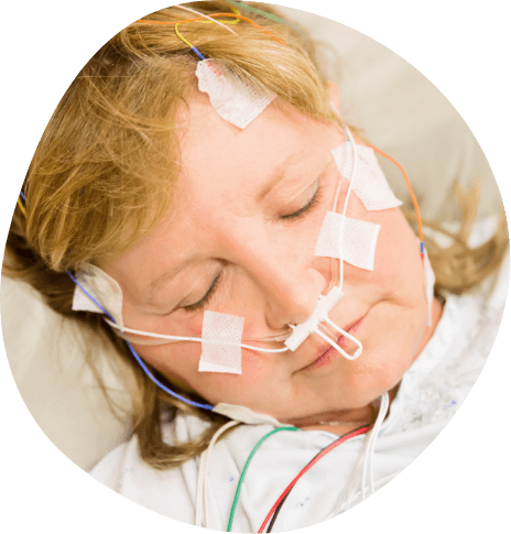 Sleeping woman with sleep testing wires across her face