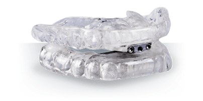 Thornton Adjustable Positioner oral appliance