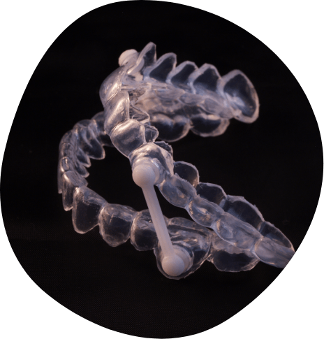 Clear oral appliance against black background